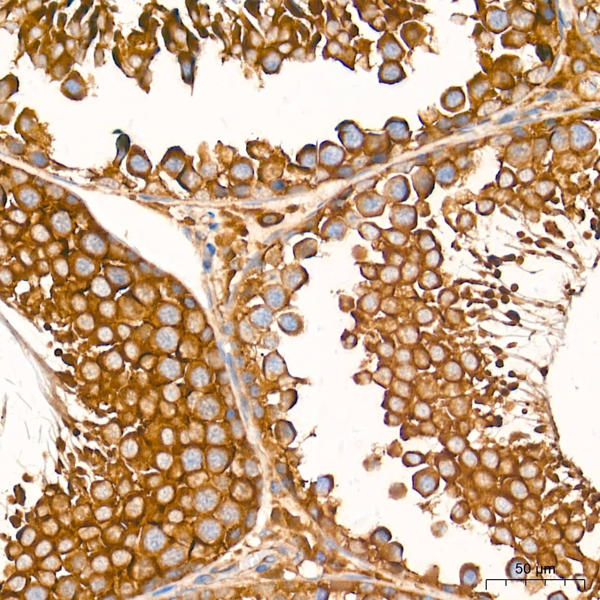 Immunohistochemistry: ATG7 Antibody (3X1W4) [ATG7] - Immunohistochemistry analysis of paraffin-embedded Rat testis tissue using [KD Validated] ATG7 Rabbit mAb  at a dilution of 1:500 (40x lens). High pressure antigen retrieval performed with 0.01M Tris-EDTA Buffer (pH 9.0) prior to IHC staining.