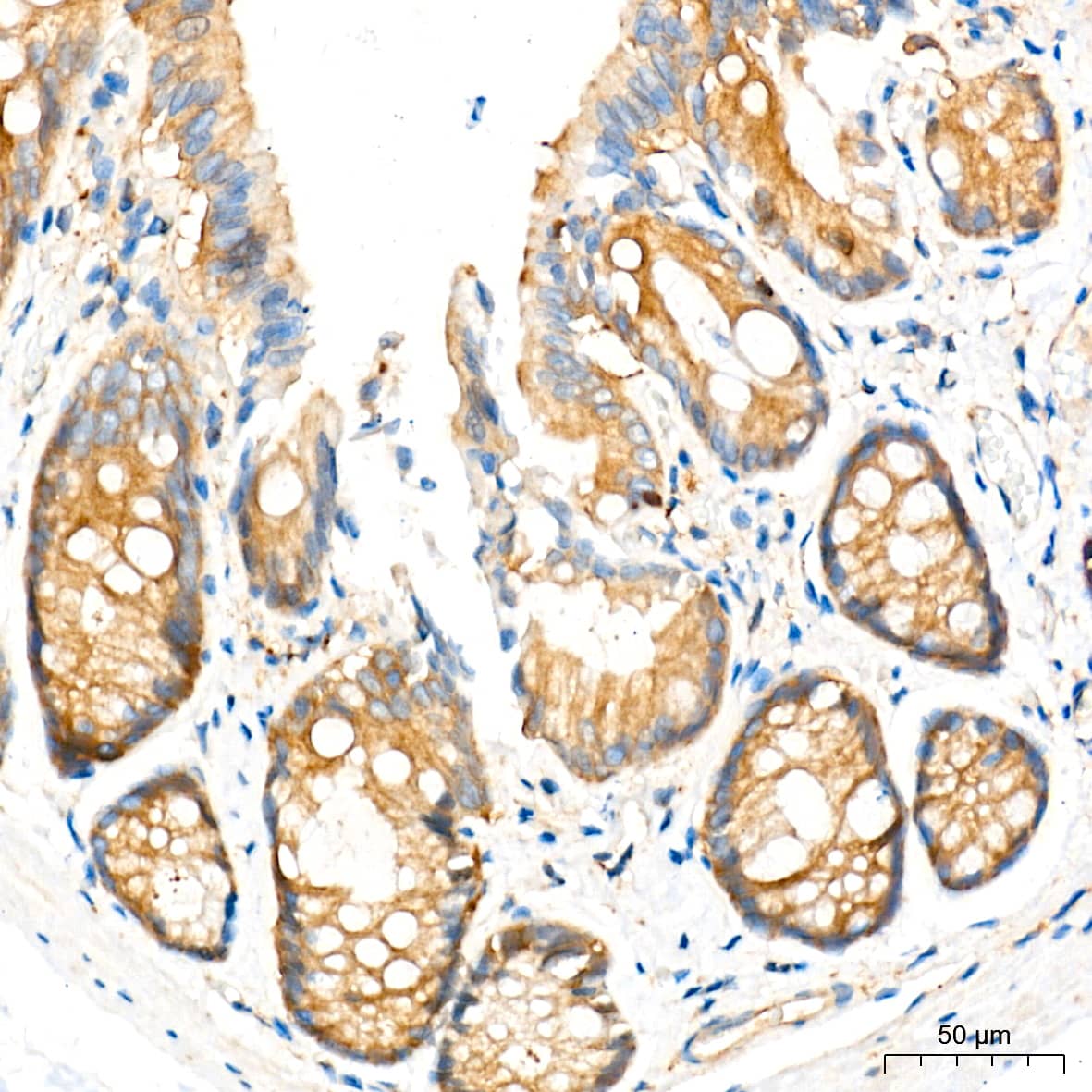 Immunohistochemistry: ATG7 Antibody (3X1W4) [ATG7] - Immunohistochemistry analysis of paraffin-embedded Rat colon tissue using [KD Validated] ATG7 Rabbit mAb  at a dilution of 1:500 (40x lens). High pressure antigen retrieval performed with 0.01M Tris-EDTA Buffer (pH 9.0) prior to IHC staining.