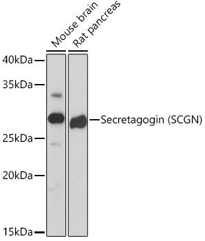 Western Blot: Secretagogin Antibody (9K8H9) [Secretagogin] - Western blot analysis of various lysates using Secretagogin (Secretagogin) Rabbit mAb  at 1:1000 dilution.Secondary antibody: HRP Goat Anti-Rabbit IgG (H+L)  at 1:10000 dilution.Lysates/proteins: 25ug per lane.Blocking buffer: 3% nonfat dry milk in TBST.Detection: ECL Basic Kit .Exposure time: 180s.