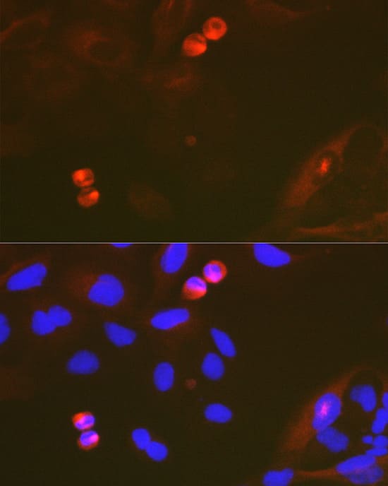 Immunocytochemistry/ Immunofluorescence: TACC3 Antibody (7S7L2) [NBP3-15816] - Immunofluorescence analysis of U-2 OS cells using TACC3 Rabbit mAb  at dilution of 1:100 (40x lens). Secondary antibody: Cy3 Goat Anti-Rabbit IgG (H+L)  at 1:500 dilution. Blue: DAPI for nuclear staining.