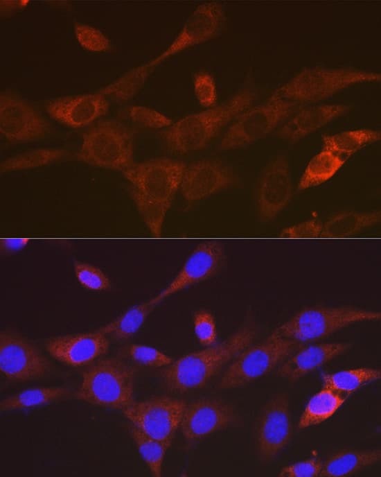Immunocytochemistry/ Immunofluorescence: TACC3 Antibody (7S7L2) [NBP3-15816] - Immunofluorescence analysis of NIH/3T3 cells using TACC3 Rabbit mAb  at dilution of 1:100 (40x lens). Secondary antibody: Cy3 Goat Anti-Rabbit IgG (H+L)  at 1:500 dilution. Blue: DAPI for nuclear staining.