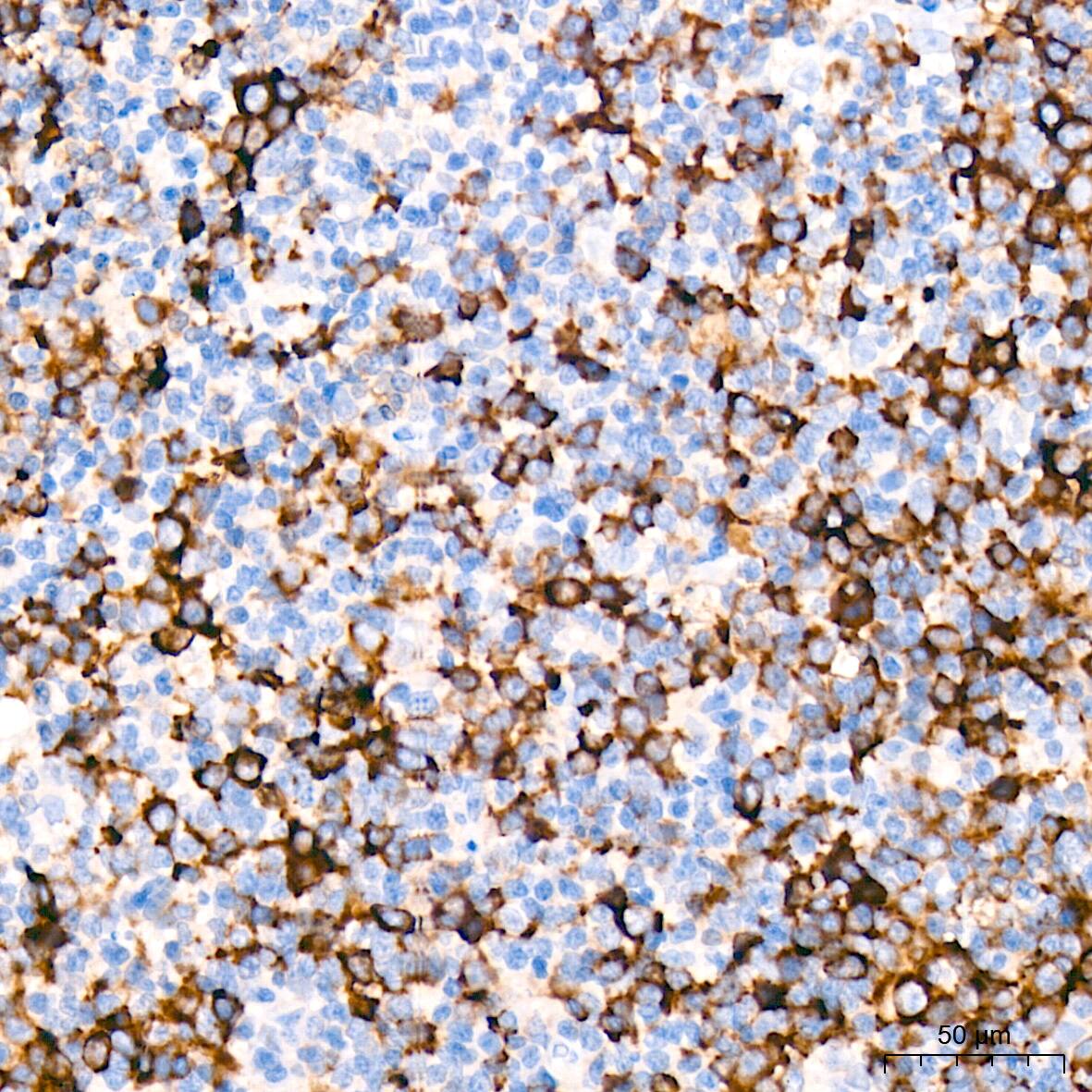 Immunohistochemistry: TACC3 Antibody (7S7L2) [NBP3-15816] - Immunohistochemistry analysis of TACC3 in paraffin-embedded human tonsil tissue using TACC3 Rabbit mAb  at a dilution of 1:200 (40x lens). High pressure antigen retrieval was performed with 0.01 M citrate buffer (pH 6.0) prior to IHC staining.
