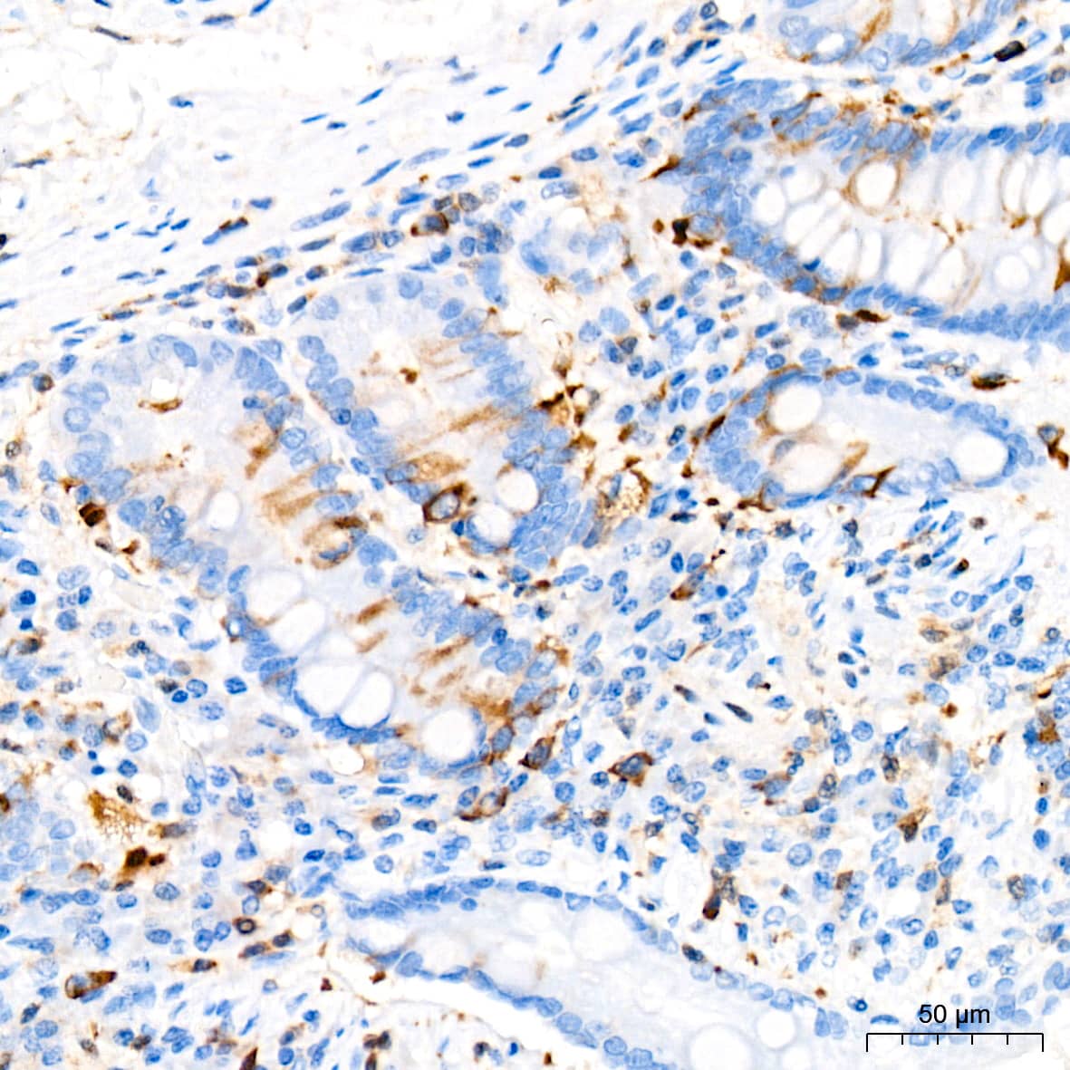 Immunohistochemistry: TACC3 Antibody (7S7L2) [NBP3-15816] - Immunohistochemistry analysis of TACC3 in paraffin-embedded human colon tissue using TACC3 Rabbit mAb  at a dilution of 1:200 (40x lens). High pressure antigen retrieval was performed with 0.01 M citrate buffer (pH 6.0) prior to IHC staining.
