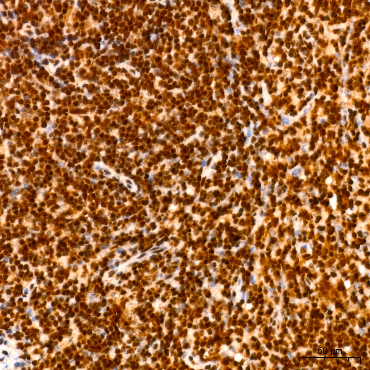 Immunohistochemistry HuR/ELAVL1 Antibody (9Q6L3)