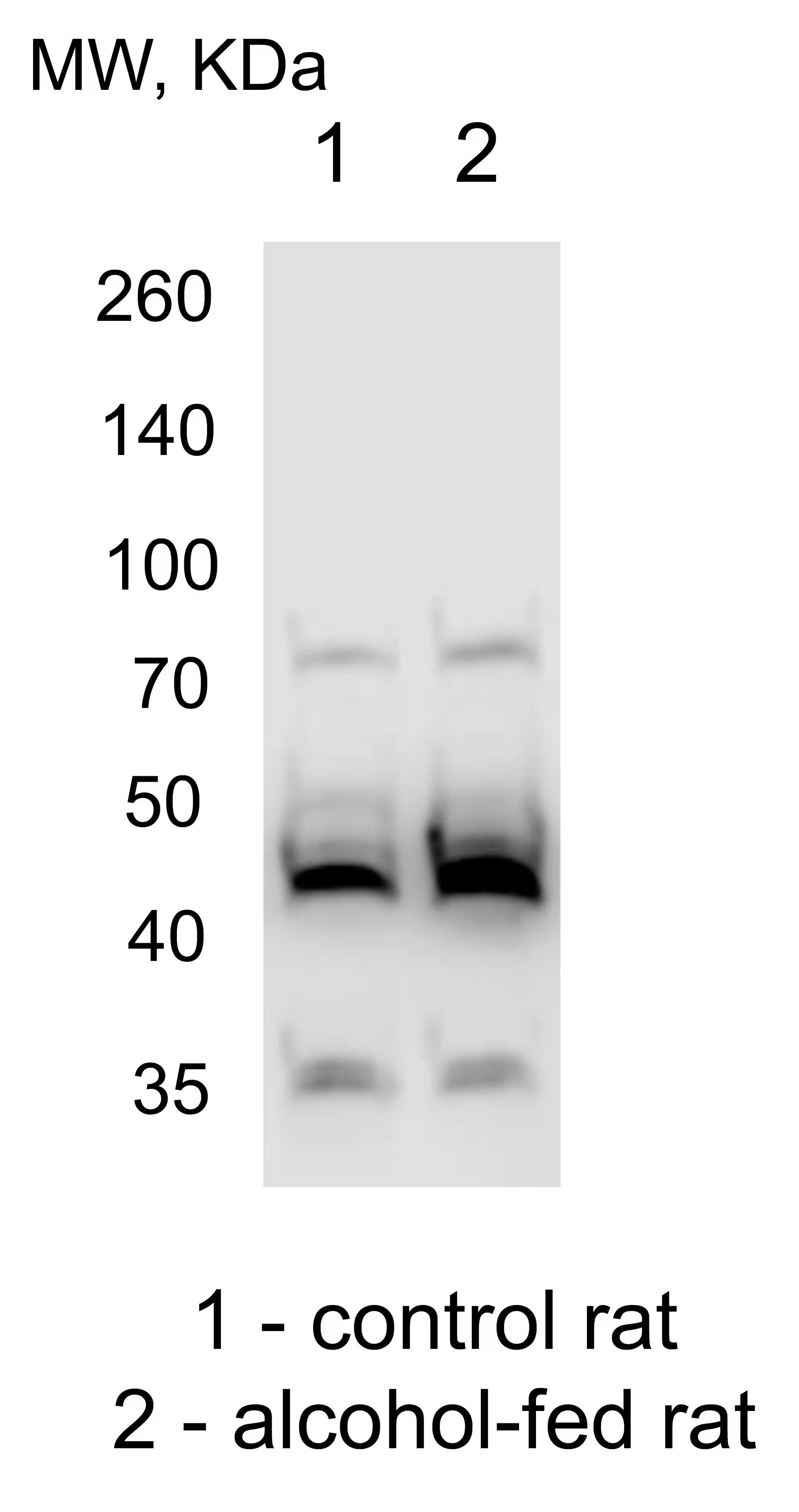 Western Blot: Rabbit alcohol dehydrogenase mAb (1X3C0) [NBP3-15822] - ADH Western blot of liver homogenates isolated from control and alcohol-fed rats. Image from a verified customer review.