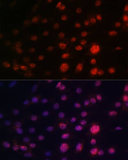 Immunocytochemistry/ Immunofluorescence: CRM1 Antibody (1J0L10) [CRM1] - Immunofluorescence analysis of C6 cells using CRM1 Rabbit mAb . Secondary antibody: Cy3-conjugated Goat anti-Rabbit IgG (H+L)  at 1:500 dilution. Blue: DAPI for nuclear staining.