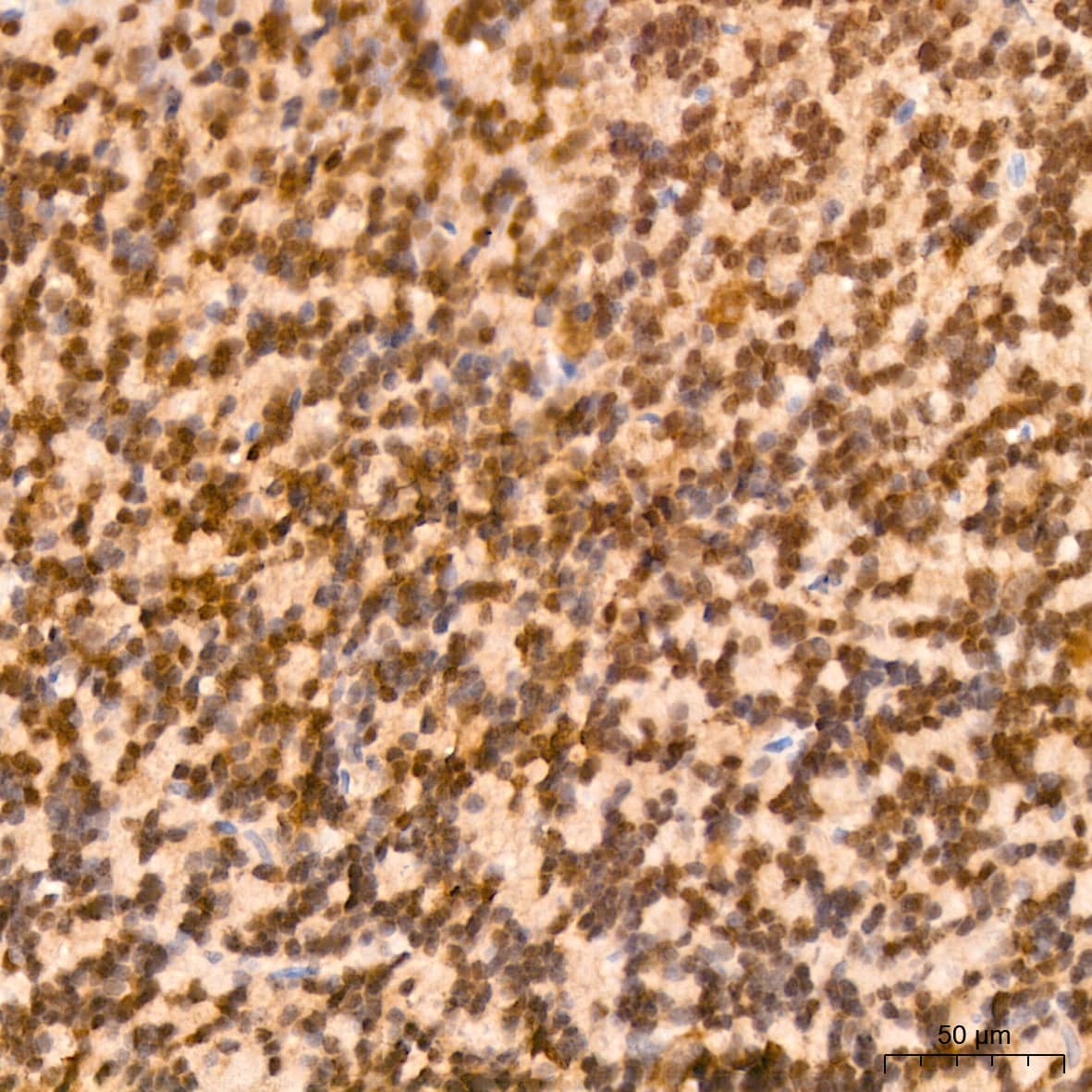 Immunohistochemistry: ERK2 Antibody (2K9N9) [ERK2] - Immunohistochemistry analysis of paraffin-embedded Rat brain tissue using ERK2 Rabbit mAb  at a dilution of 1:200 (40x lens). High pressure antigen retrieval performed with 0.01M Citrate Bufferr (pH 6.0) prior to IHC staining.