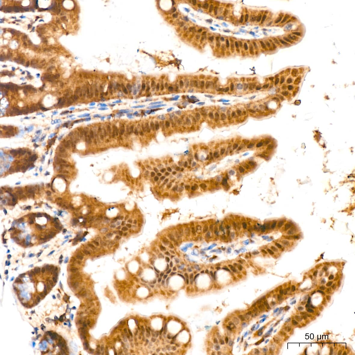 Immunohistochemistry: ERK2 Antibody (2K9N9) [ERK2] - Immunohistochemistry analysis of paraffin-embedded Mouse intestin tissue using ERK2 Rabbit mAb  at a dilution of 1:200 (40x lens). High pressure antigen retrieval performed with 0.01M Citrate Bufferr (pH 6.0) prior to IHC staining.