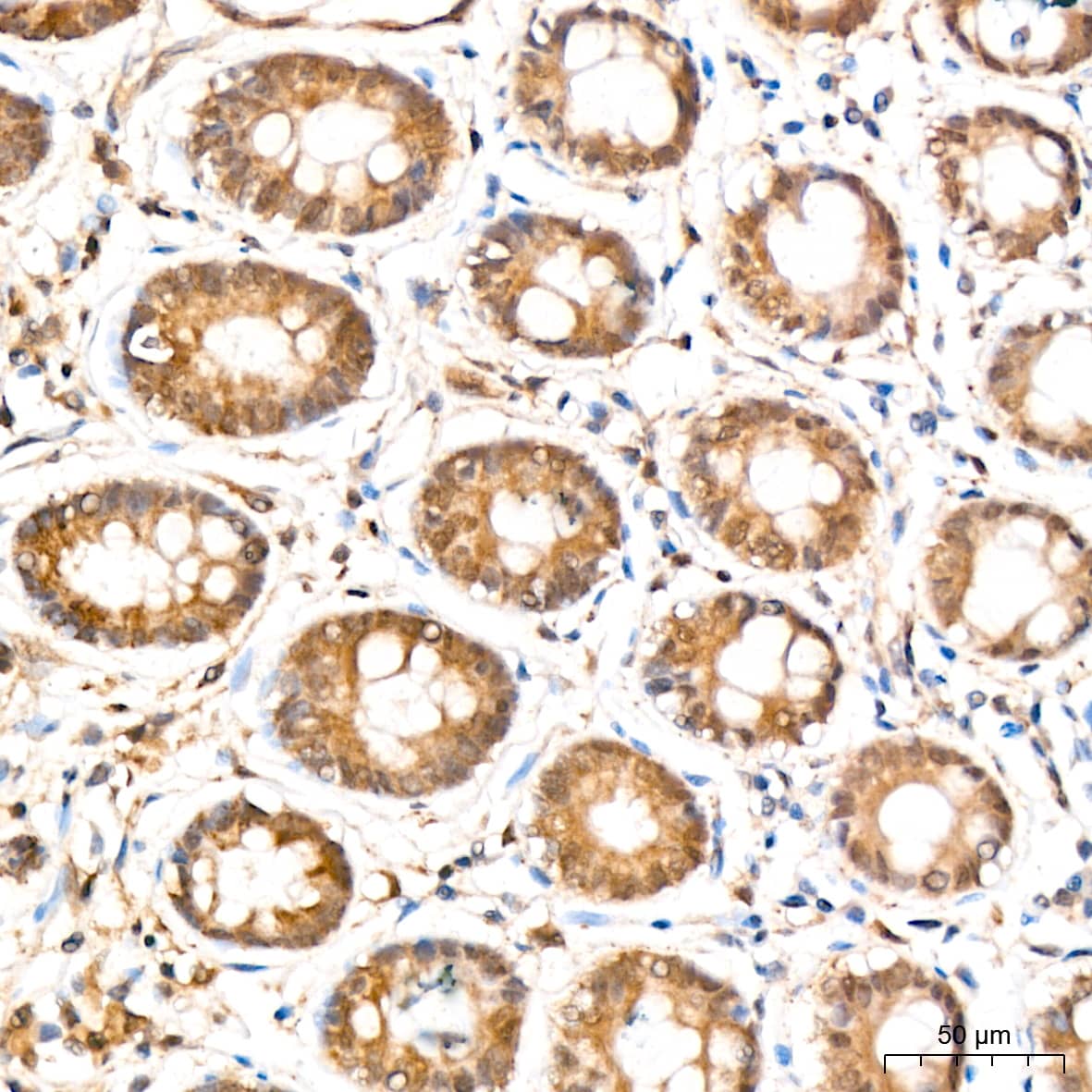 Immunohistochemistry: ERK2 Antibody (2K9N9) [ERK2] - Immunohistochemistry analysis of paraffin-embedded Human colon tissue using ERK2 Rabbit mAb  at a dilution of 1:200 (40x lens). High pressure antigen retrieval performed with 0.01M Citrate Bufferr (pH 6.0) prior to IHC staining.