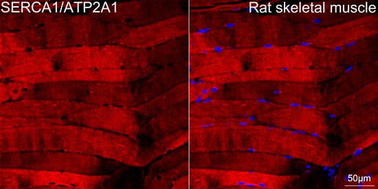 Immunocytochemistry/ Immunofluorescence: SERCA1 ATPase Antibody (2T8S3) [NBP3-15830] - Confocal imaging of paraffin-embedded Rat skeletal muscle tissue using SERCA1 ATPase Rabbit mAb  followed by a further incubation with Cy3 Goat Anti-Rabbit IgG (H+L)  . DAPI was used for nuclear staining (Blue). High pressure antigen retrieval performed with 0.01M Citrate Buffer(pH 6.0) prior to IF staining. Objective: 40x.