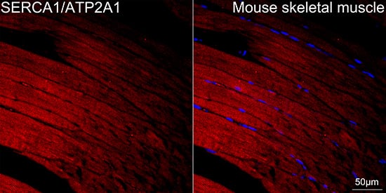 Immunocytochemistry/ Immunofluorescence: SERCA1 ATPase Antibody (2T8S3) [NBP3-15830] - Confocal imaging of paraffin-embedded Mouse skeletal muscle tissue using SERCA1 ATPase Rabbit mAb  followed by a further incubation with Cy3 Goat Anti-Rabbit IgG (H+L)  . DAPI was used for nuclear staining (Blue). High pressure antigen retrieval performed with 0.01M Citrate Buffer(pH 6.0) prior to IF staining. Objective: 40x.