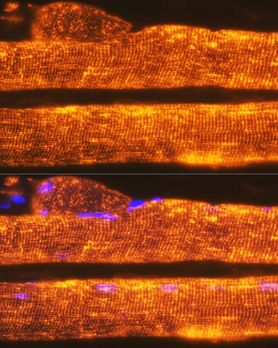 Immunocytochemistry/ Immunofluorescence Calsequestrin 1 Antibody (5P6U2)