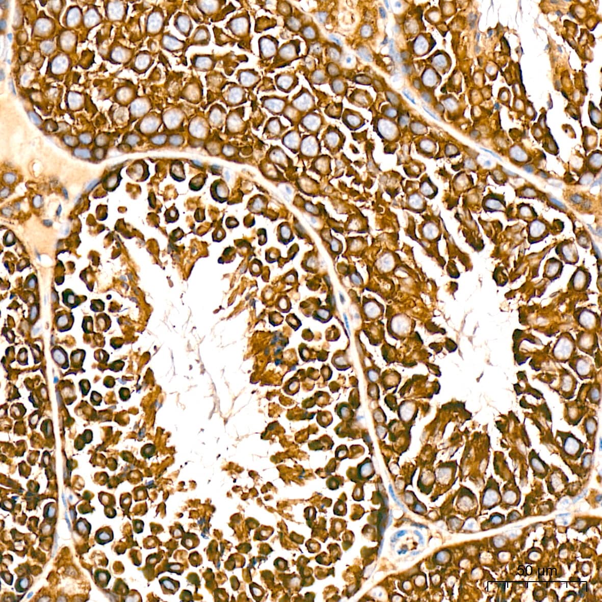 Immunohistochemistry: alpha COP I Antibody (3W6Y6) [NBP3-15839] - Immunohistochemistry analysis of alpha COP I in paraffin-embedded mouse testis tissue using alpha COP I Rabbit mAb  at a dilution of 1:200 (40x lens). High pressure antigen retrieval was performed with 0.01 M citrate buffer (pH 6.0) prior to IHC staining.