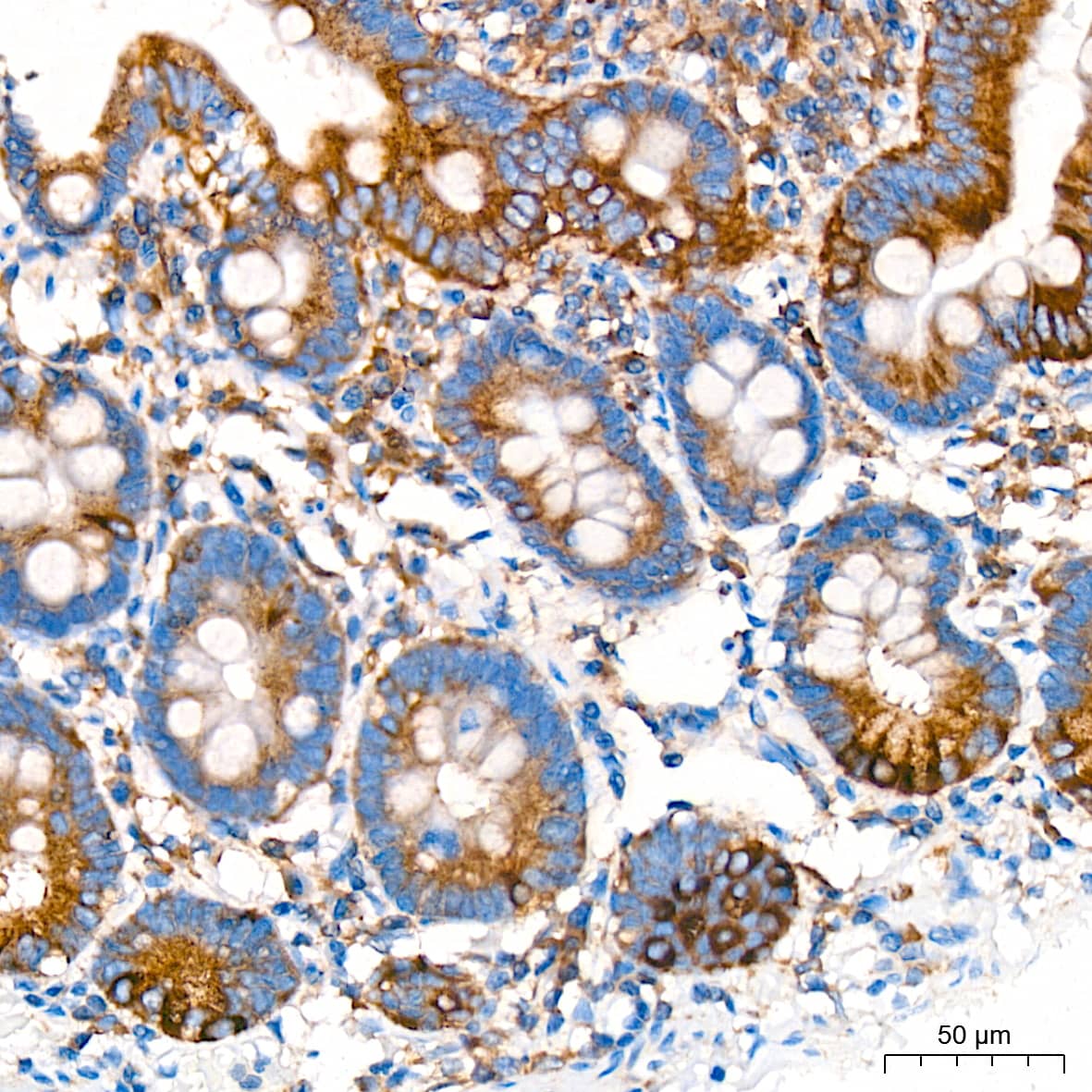 Immunohistochemistry: alpha COP I Antibody (3W6Y6) [NBP3-15839] - Immunohistochemistry analysis of alpha COP I in paraffin-embedded human colon tissue using alpha COP I Rabbit mAb  at a dilution of 1:200 (40x lens). High pressure antigen retrieval was performed with 0.01 M citrate buffer (pH 6.0) prior to IHC staining.