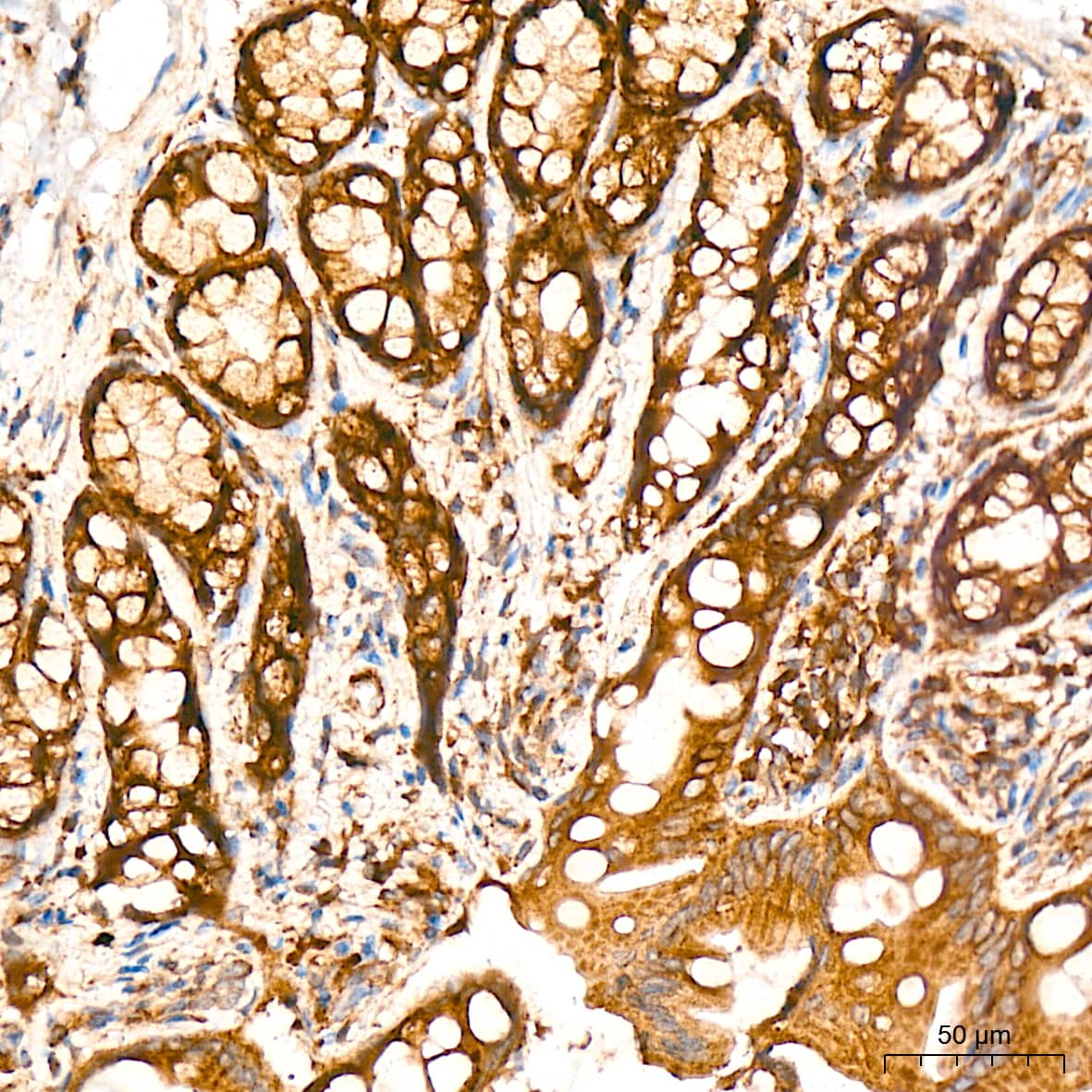 Immunohistochemistry: alpha COP I Antibody (3W6Y6) [NBP3-15839] - Immunohistochemistry analysis of alpha COP I in paraffin-embedded rat colon tissue using alpha COP I Rabbit mAb  at a dilution of 1:200 (40x lens). High pressure antigen retrieval was performed with 0.01 M citrate buffer (pH 6.0) prior to IHC staining.