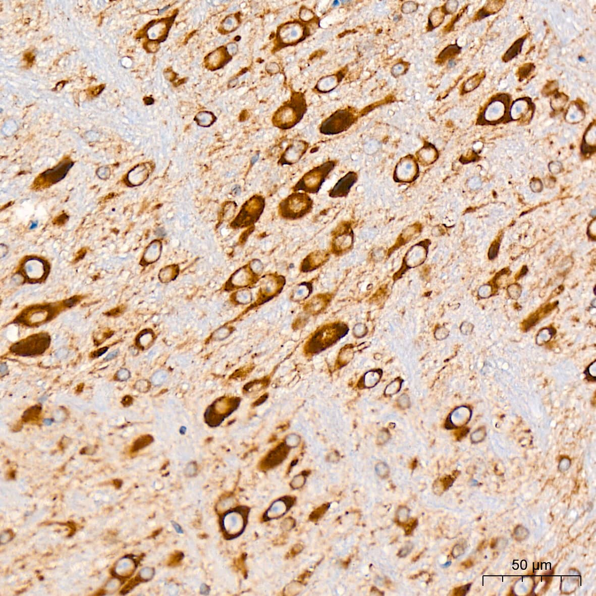 Immunohistochemistry: alpha COP I Antibody (3W6Y6) [NBP3-15839] - Immunohistochemistry analysis of alpha COP I in paraffin-embedded mouse brain tissue using alpha COP I Rabbit mAb  at a dilution of 1:200 (40x lens). High pressure antigen retrieval was performed with 0.01 M citrate buffer (pH 6.0) prior to IHC staining.