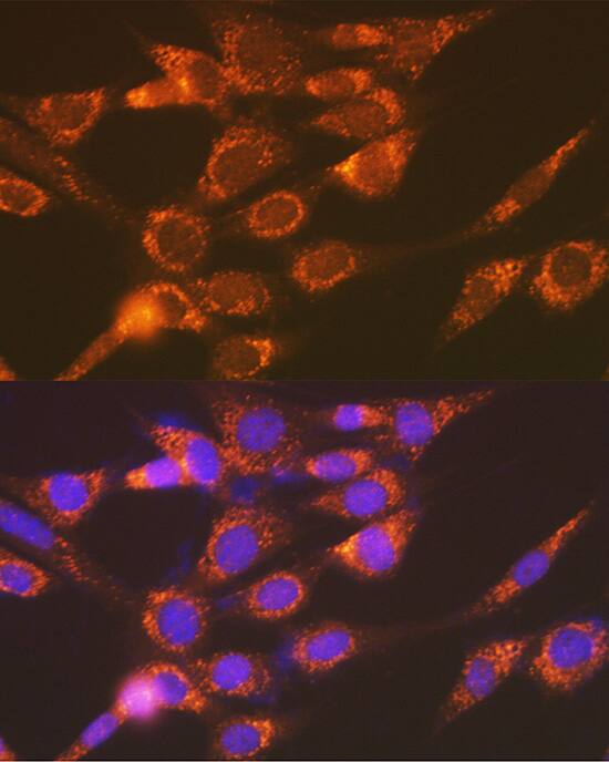 Immunocytochemistry/ Immunofluorescence: Versican Antibody (6D8K9) [NBP3-15841] - Immunofluorescence analysis of NIH-3T3 cells using Versican Rabbit mAb  at dilution of 1:100 (40x lens). Secondary antibody: Cy3-conjugated Goat anti-Rabbit IgG (H+L)  at 1:500 dilution. Blue: DAPI for nuclear staining.