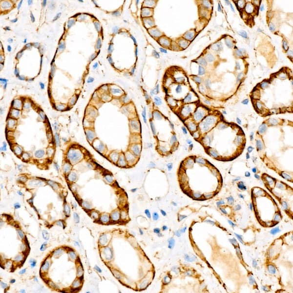 Immunohistochemistry: beta-Catenin Antibody (6A3P2) [beta-Catenin] - Immunohistochemistry analysis of paraffin-embedded Human kidney using [KO Validated] beta-Catenin Rabbit mAb  at dilution of 1:100 (40x lens). High pressure antigen retrieval performed with 0.01M Citrate Bufferr (pH 6.0) prior to IHC staining.