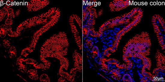 Immunocytochemistry/ Immunofluorescence: beta-Catenin Antibody (6A3P2) [beta-Catenin] - Confocal imaging of paraffin-embedded Mouse colon tissue using [KO Validated] beta-Catenin Rabbit mAb  followed by a further incubation with Cy3 Goat Anti-Rabbit IgG (H+L)  . DAPI was used for nuclear staining (Blue). High pressure antigen retrieval performed with 0.01M Citrate Buffer (pH 6.0) prior to IF staining. Objective: 40x.