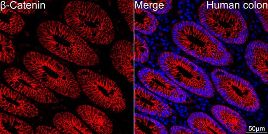 Immunocytochemistry/ Immunofluorescence: beta-Catenin Antibody (6A3P2) [beta-Catenin] - Confocal imaging of paraffin-embedded Human colon tissue using [KO Validated] beta-Catenin Rabbit mAb  followed by a further incubation with Cy3 Goat Anti-Rabbit IgG (H+L)  . DAPI was used for nuclear staining (Blue). High pressure antigen retrieval performed with 0.01M Citrate Buffer (pH 6.0) prior to IF staining. Objective: 40x.