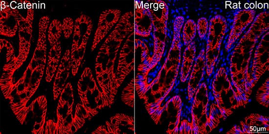 Immunocytochemistry/ Immunofluorescence: beta-Catenin Antibody (6A3P2) [beta-Catenin] - Confocal imaging of paraffin-embedded Rat colon tissue using [KO Validated] beta-Catenin Rabbit mAb  followed by a further incubation with Cy3 Goat Anti-Rabbit IgG (H+L)  . DAPI was used for nuclear staining (Blue). High pressure antigen retrieval performed with 0.01M Citrate Buffer (pH 6.0) prior to IF staining. Objective: 40x.