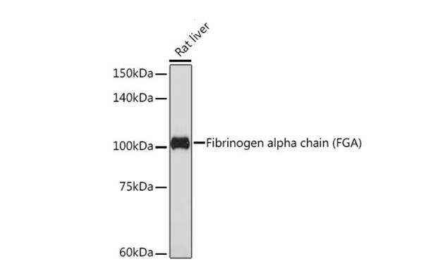Analysis of various lysates using Fibrinogen alpha chain (FGA) (FGA) Rabbit mAb  at 1:1000 dilution.Secondary antibody: HRP-conjugated Goat anti-Rabbit IgG (H+L) at 1:10000 dilution.Lysates/proteins: 25μg per lane.Blocking buffer: 3% nonfat dry milk in TBST.Detection: ECL Basic Kit. Exposure time: 180s.