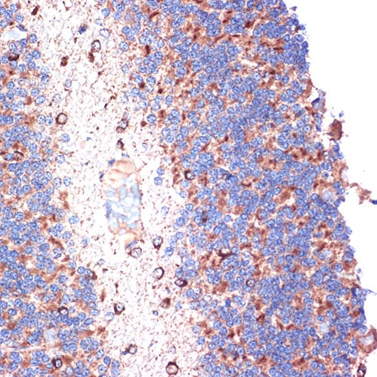 Immunohistochemistry: TTC11 Antibody (6S1G4) [TTC11] - Immunohistochemistry analysis of paraffin-embedded Rat brain tissue using [KO Validated] TTC11 Rabbit mAb  at a dilution of 1:100 (40x lens). Microwave antigen retrieval performed with 0.01M Tris-EDTA Buffer (pH 9.0) prior to IHC staining.