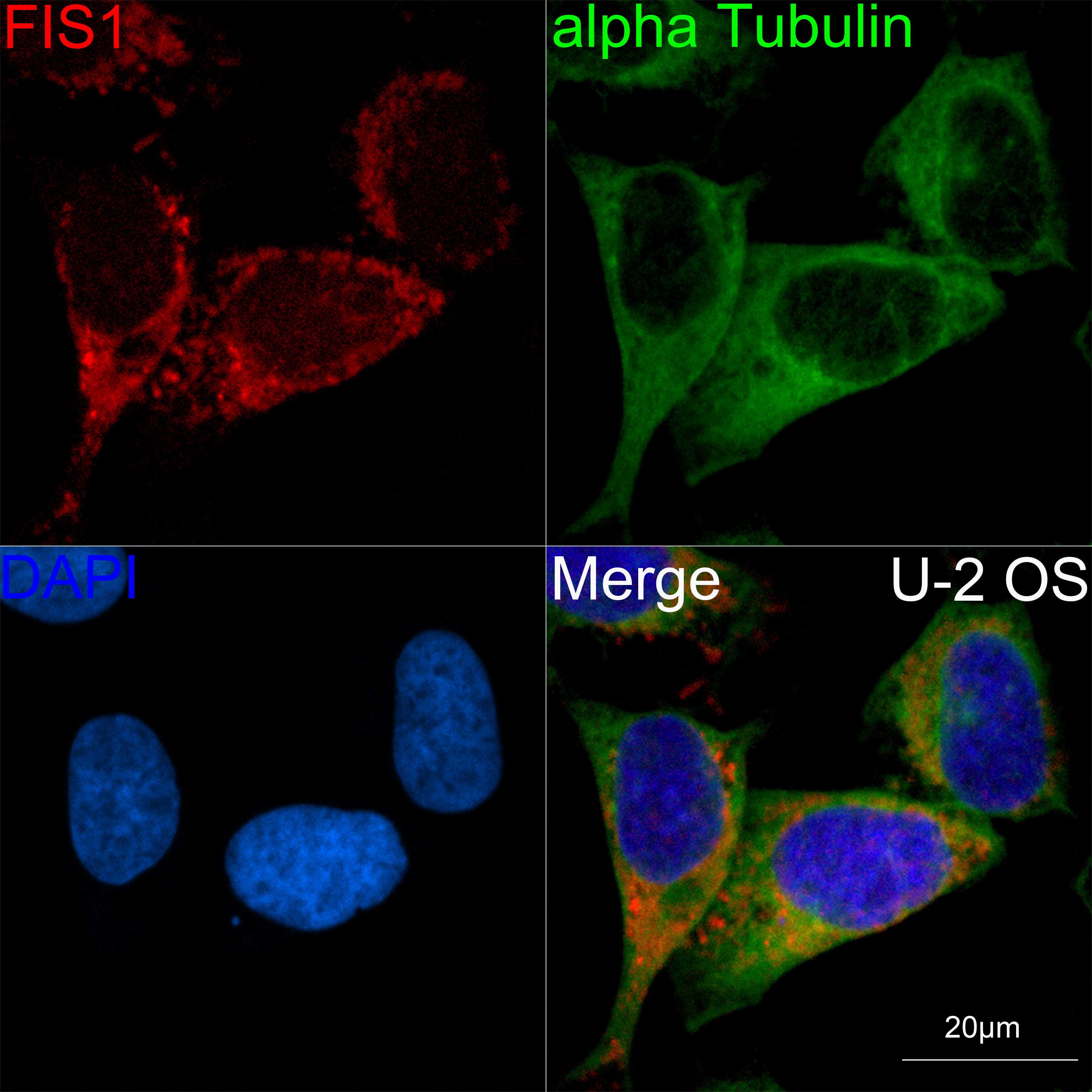 Immunocytochemistry/ Immunofluorescence: TTC11 Antibody (6S1G4) [TTC11] - Confocal imaging of U-2 OS cells using [KO Validated] TTC11 Rabbit mAb . The cells were counterstained with alpha-Tubulin Mouse mAb  (Green). DAPI was used for nuclear staining (blue). Objective: 60x.