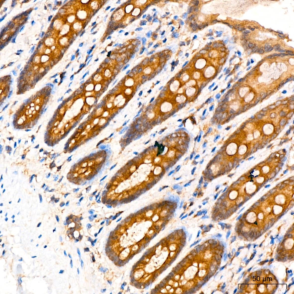 Immunohistochemistry: ATG5 Antibody (8L7X6) [ATG5] - Immunohistochemistry analysis of paraffin-embedded rat colon tissue using [KO Validated] ATG5 Rabbit mAb  at a dilution of 1:200 (40x lens). High pressure antigen retrieval performed with 0.01M Citrate Buffer (pH 6.0) prior to IHC staining.