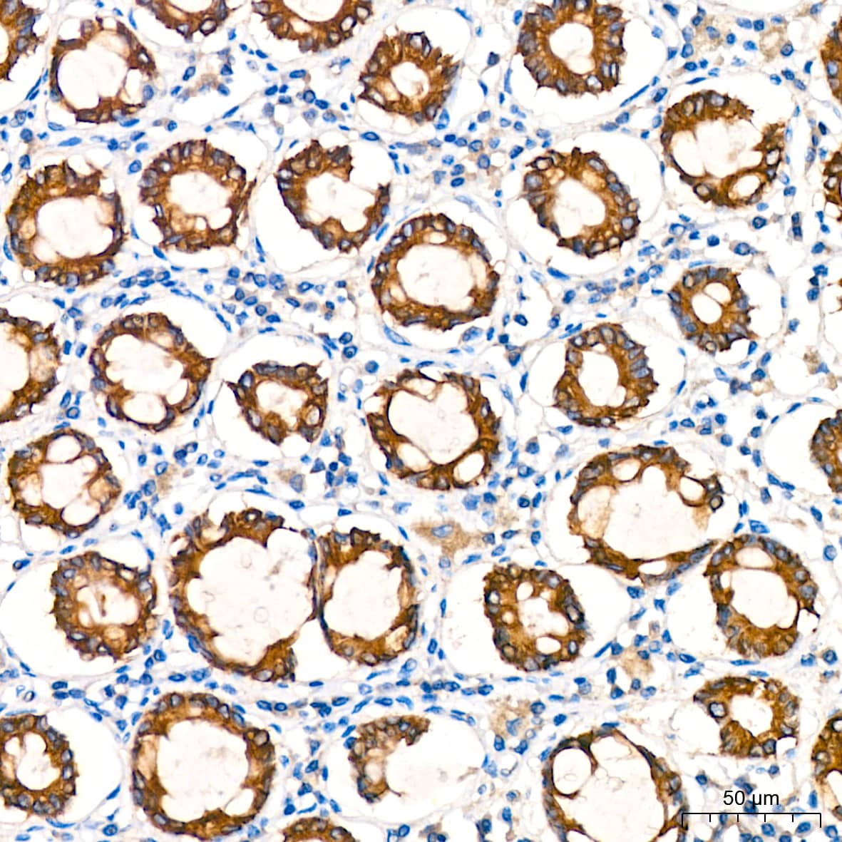 Immunohistochemistry: ATG5 Antibody (8L7X6) [ATG5] - Immunohistochemistry analysis of paraffin-embedded Human colon tissue using [KO Validated] ATG5 Rabbit mAb  at a dilution of 1:200 (40x lens). High pressure antigen retrieval performed with 0.01M Citrate Buffer (pH 6.0) prior to IHC staining.