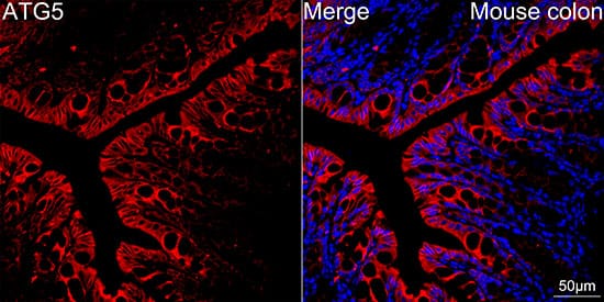 Immunocytochemistry/ Immunofluorescence: ATG5 Antibody (8L7X6) [ATG5] - Confocal imaging of paraffin-embedded Mouse colon tissue using [KO Validated] ATG5 Rabbit mAb  followed by a further incubation with Cy3 Goat Anti-Rabbit IgG (H+L)  . DAPI was used for nuclear staining (Blue). High pressure antigen retrieval performed with 0.01M Citrate Buffer (pH 6.0) prior to IF staining. Objective: 40x.