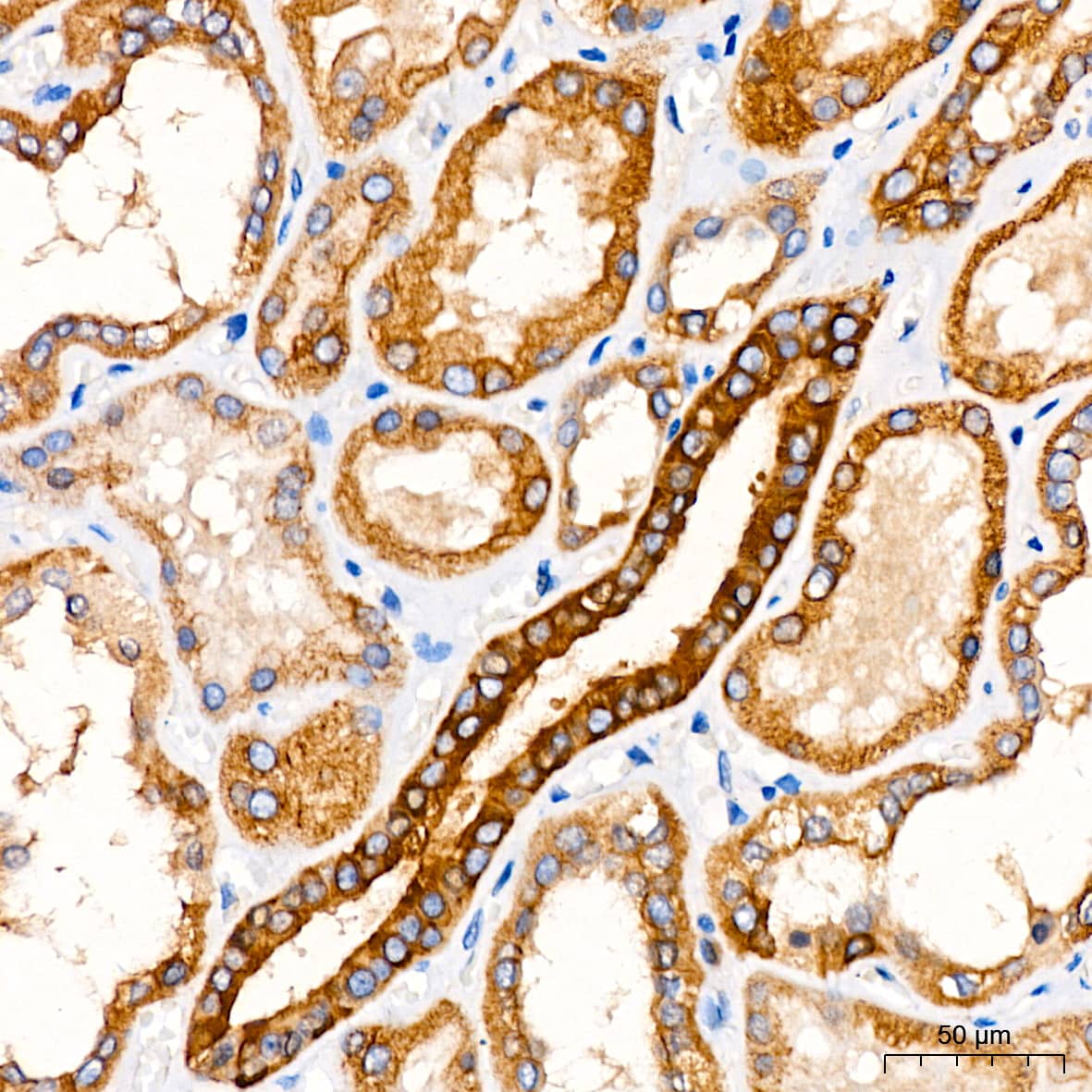 Immunohistochemistry: ATG5 Antibody (8L7X6) [ATG5] - Immunohistochemistry analysis of paraffin-embedded Human kidney tissue using [KO Validated] ATG5 Rabbit mAb  at a dilution of 1:200 (40x lens). High pressure antigen retrieval performed with 0.01M Citrate Buffer (pH 6.0) prior to IHC staining.