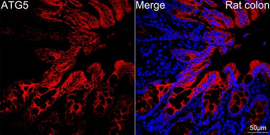 Immunocytochemistry/ Immunofluorescence: ATG5 Antibody (8L7X6) [ATG5] - Confocal imaging of paraffin-embedded Rat colon tissue using [KO Validated] ATG5 Rabbit mAb  followed by a further incubation with Cy3 Goat Anti-Rabbit IgG (H+L)  . DAPI was used for nuclear staining (Blue). High pressure antigen retrieval performed with 0.01M Citrate Buffer (pH 6.0) prior to IF staining. Objective: 40x.