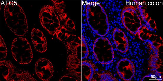 Immunocytochemistry/ Immunofluorescence: ATG5 Antibody (8L7X6) [ATG5] - Confocal imaging of paraffin-embedded Human colon tissue using [KO Validated] ATG5 Rabbit mAb  followed by a further incubation with Cy3 Goat Anti-Rabbit IgG (H+L)  . DAPI was used for nuclear staining (Blue). High pressure antigen retrieval performed with 0.01M Citrate Buffer (pH 6.0) prior to IF staining. Objective: 40x.