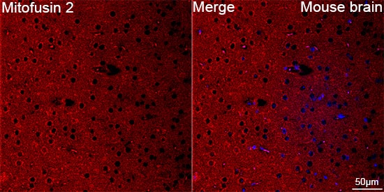 Immunocytochemistry/ Immunofluorescence: Mitofusin 2 Antibody (4H10F8) [Mitofusin 2] - Confocal imaging of paraffin-embedded Mouse brain tissue using Mitofusin 2 Rabbit mAb  followed by a further incubation with Cy3 Goat Anti-Rabbit IgG (H+L)  . DAPI was used for nuclear staining (Blue). Objective: 40x. Perform microwave antigen retrieval with 0.01 M citrate buffer (pH 6.0) prior to IF staining.