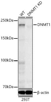 <b>Genetic Strategies Validation. </b>Western Blot: DNMT1 Antibody (1K5K8) [DNMT1] - Western blot analysis of lysates from wild type (WT) and DNMT1   knockdown (KD) 293T cells, using [KD Validated] DNMT1 Rabbit mAb  at1:1000 dilution.Secondary antibody: HRP-conjugated Goat anti-Rabbit IgG (H+L)  at1:10000 dilution.Lysates/proteins: 25ug per lane.Blocking buffer: 3% nonfat dry milk in TBST.Detection: ECL Basic Kit .Exposure time: 30s.