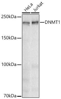 Western Blot: DNMT1 Antibody (1K5K8) [DNMT1] - Western blot analysis of various lysates using [KD Validated] DNMT1 Rabbit mAb  at 1:1000 dilution incubated overnight at 4C.Secondary antibody: HRP-conjugated Goat anti-Rabbit IgG (H+L)  at 1:10000 dilution. Lysates/proteins: 25 ug per lane.Blocking buffer: 3% nonfat dry milk in TBST.Detection: ECL Basic Kit Exposure time: 30 s.