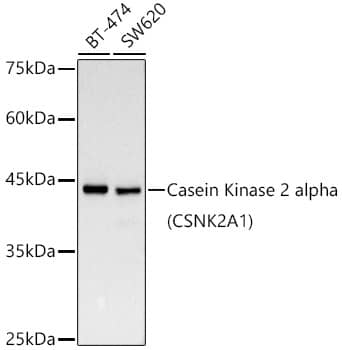 Western Blot: Casein Kinase 2 alpha Antibody (2P3M7) [NBP3-15858] - Western blot analysis of various lysates, using Casein Kinase 2 alpha antibody  at  1:1000 dilution.Secondary antibody: HRP Goat Anti-Rabbit IgG (H+L)  at 1:10000 dilution.Lysates/proteins: 25ug per lane.Blocking buffer: 3% nonfat dry milk in TBST.Detection: ECL Basic Kit .Exposure time: 30s.