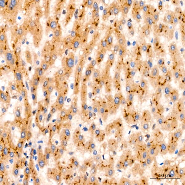 Immunohistochemistry: PIM1 Antibody (4C8D0) [PIM1] - Immunohistochemistry analysis of paraffin-embedded Human liver using PIM1 Rabbit mAb  at dilution of 1:200 (40x lens). High pressure antigen retrieval performed with 0.01M Tris/EDTA Buffer (pH 9.0) prior to IHC staining.