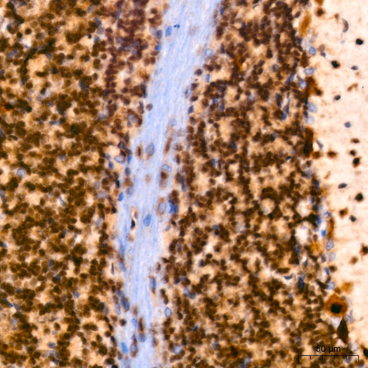 Immunohistochemistry: PIM1 Antibody (4C8D0) [PIM1] - Immunohistochemistry analysis of paraffin-embedded Rat brain using PIM1 Rabbit mAb  at dilution of 1:200 (40x lens). High pressure antigen retrieval performed with 0.01M Tris/EDTA Buffer (pH 9.0) prior to IHC staining.