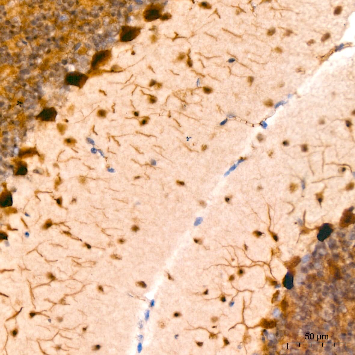 Immunohistochemistry: PIM1 Antibody (4C8D0) [PIM1] - Immunohistochemistry analysis of paraffin-embedded Mouse brain using PIM1 Rabbit mAb  at dilution of 1:200 (40x lens). High pressure antigen retrieval performed with 0.01M Tris/EDTA Buffer (pH 9.0) prior to IHC staining.