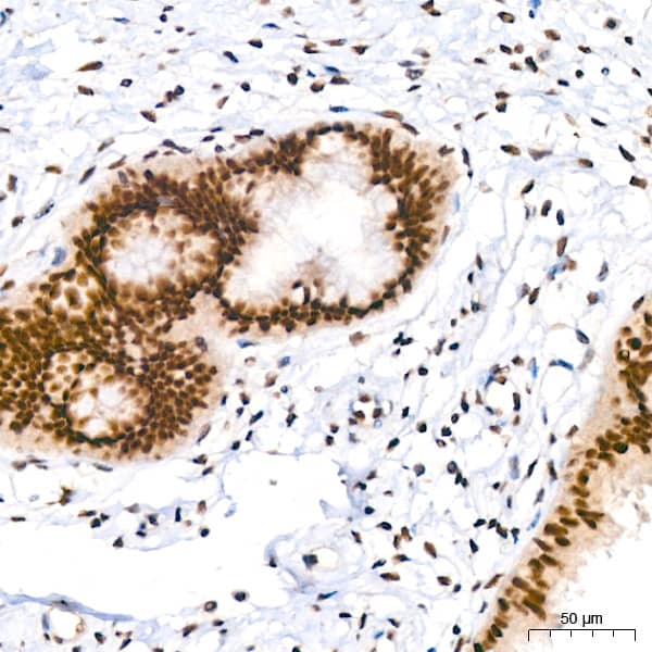 Immunohistochemistry: PIM1 Antibody (4C8D0) [PIM1] - Immunohistochemistry analysis of paraffin-embedded Human cervix using PIM1 Rabbit mAb  at dilution of 1:200 (40x lens). High pressure antigen retrieval performed with 0.01M Tris/EDTA Buffer (pH 9.0) prior to IHC staining.