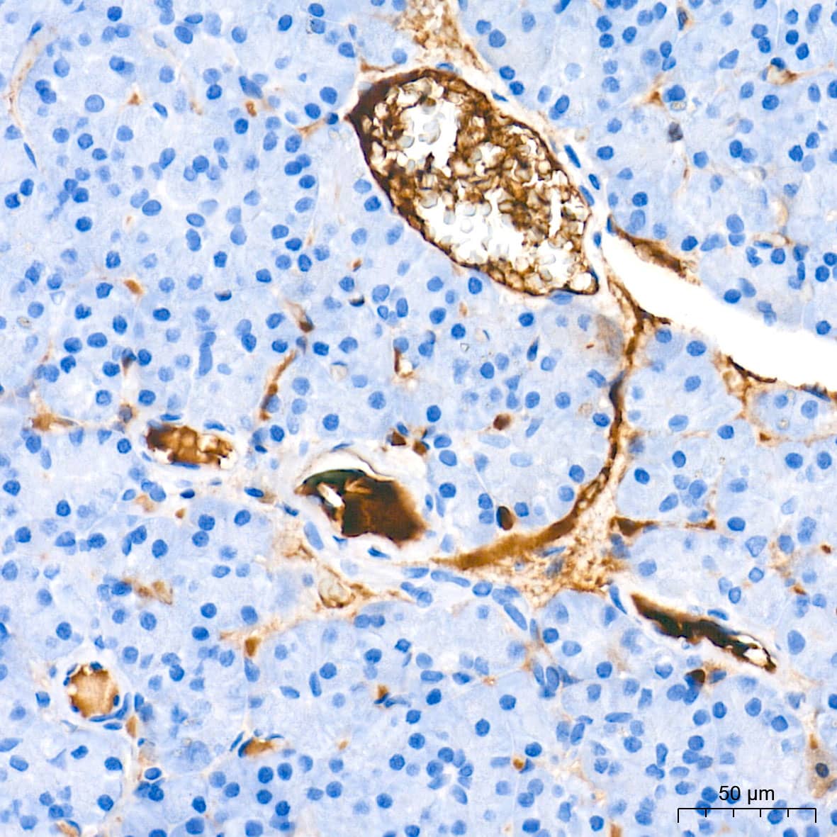 Immunohistochemistry: Ceruloplasmin Antibody (6C3K9) [Ceruloplasmin] - Immunohistochemistry analysis of paraffin-embedded Human pancreas tissue using Ceruloplasmin Rabbit mAb  at a dilution of 1:10000 (40x lens). High pressure antigen retrieval performed with 0.01M Tris-EDTA Buffer (pH 9.0) prior to IHC staining.