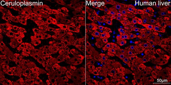 Immunocytochemistry/ Immunofluorescence: Ceruloplasmin Antibody (6C3K9) [Ceruloplasmin] - Confocal imaging of human liver using Ceruloplasmin Rabbit mAb  . DAPI was used for nuclear staining (blue). Objective: 40x. Perform high pressure antigen retrieval with 10 mM citrate buffer pH 6.0 before commencing with IF staining protocol.