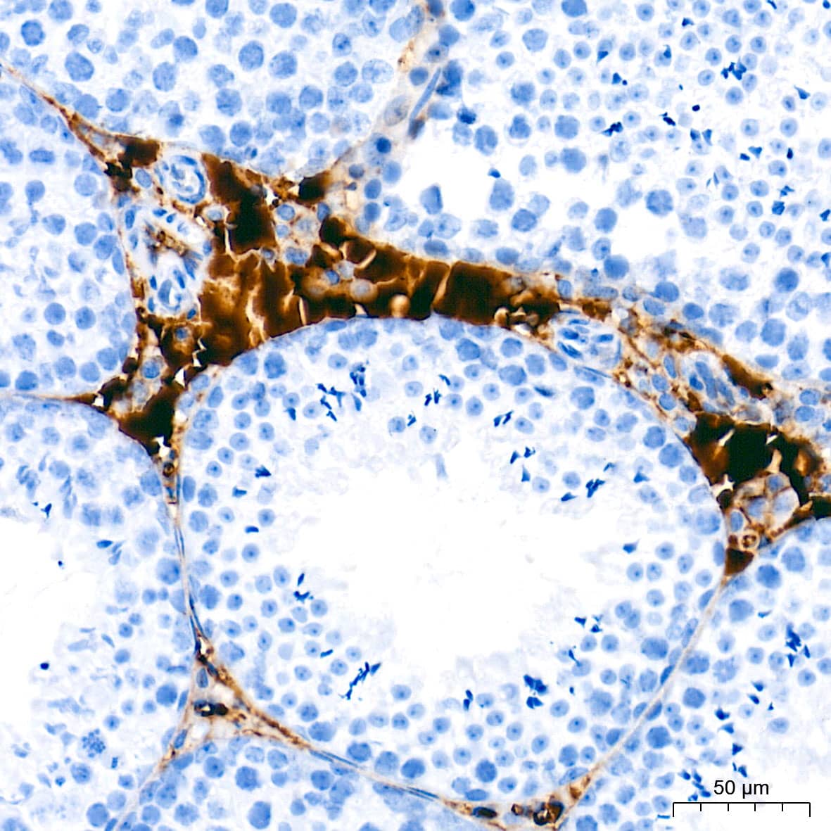 Immunohistochemistry Ceruloplasmin Antibody (6C3K9)