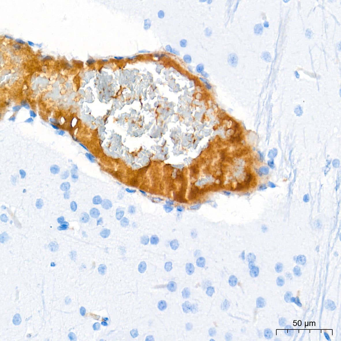 Immunohistochemistry Ceruloplasmin Antibody (6C3K9)