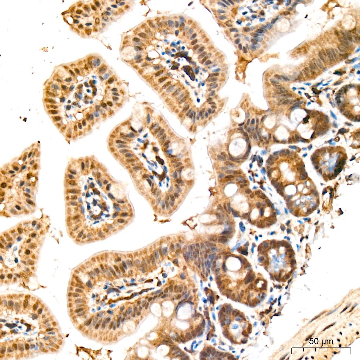 Immunohistochemistry: HspA4 Antibody (10A9C5) [HspA4] - Immunohistochemistry analysis of HspA4 in paraffin-embedded mouse intestin tissue using HspA4 Rabbit mAb  at a dilution of 1:200 (40x lens). High pressure antigen retrieval was performed with 0.01 M citrate buffer (pH 6.0) prior to IHC staining.
