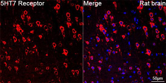 Immunocytochemistry/ Immunofluorescence: 5-HT7 Antibody (4E6D2) [5-HT7] - Confocal imaging of paraffin-embedded Rat brain  using 5-HT7 Rabbit mAb   followed by a further incubation with Cy3 Goat Anti-Rabbit IgG (H+L) .DAPI was used for nuclear staining (Blue). Objective: 40x. Perform microwave antigen retrieval with 0.01 M citRate buffer (pH 6.0) prior to IF staining.