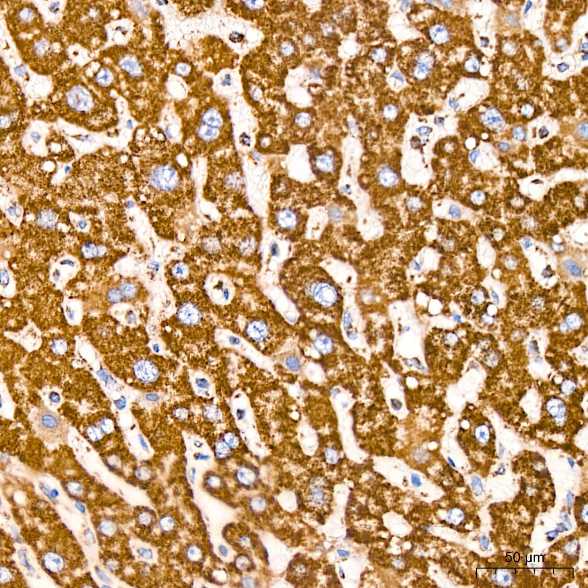 Immunohistochemistry: VDAC1 Antibody (6B1K1) [VDAC1] - Immunohistochemistry analysis of paraffin-embedded Human liver tissue using VDAC1 Rabbit mAb  at a dilution of 1:200 (40x lens). High pressure antigen retrieval performed with 0.01M Citrate Bufferr (pH 6.0) prior to IHC staining.