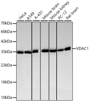 Western Blot: VDAC1 Antibody (6B1K1) [VDAC1] - Western blot analysis of various lysates using VDAC1 Rabbit mAb  at 1:5000 dilution incubated overnight at 4C.Secondary antibody: HRP-conjugated Goat anti-Rabbit IgG (H+L)  at 1:10000 dilution.Lysates/proteins: 25 ug per lane.Blocking buffer: 3% nonfat dry milk in TBST.Detection: ECL Basic Kit .Exposure time: 15s.